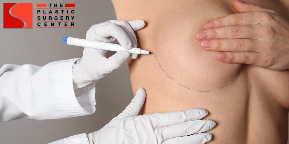 Breast procedures –