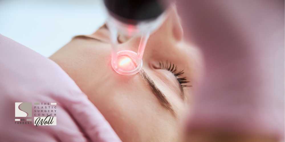 InMode Laser Treatment Shreveport